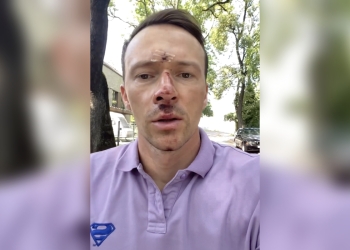 самокаты в Варшаве