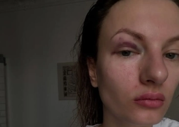 Беларуску избили в Варшаве