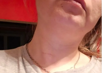 беларусов избили в Гданьске